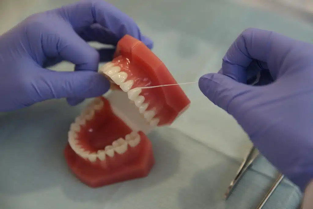 Accueil Formation de la plaque dentaire bactérienne sur les dents