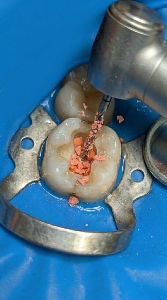 eliminate metal piece from photo 202606201615