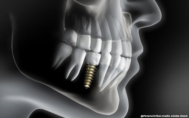 dental 2437166914