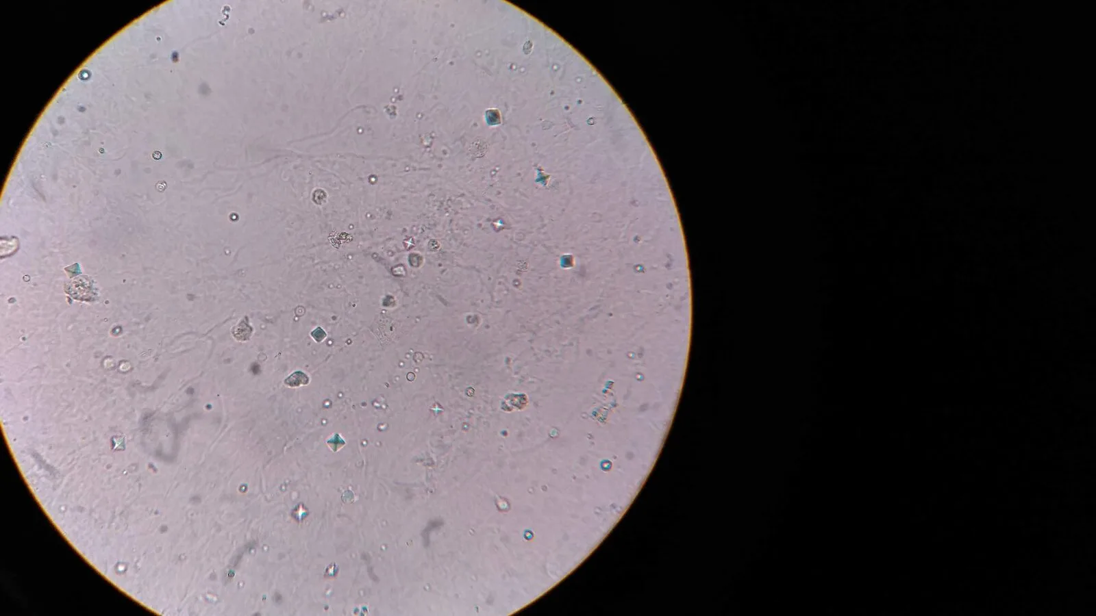 Bactéries de la plaque dentaire observées au microscope
