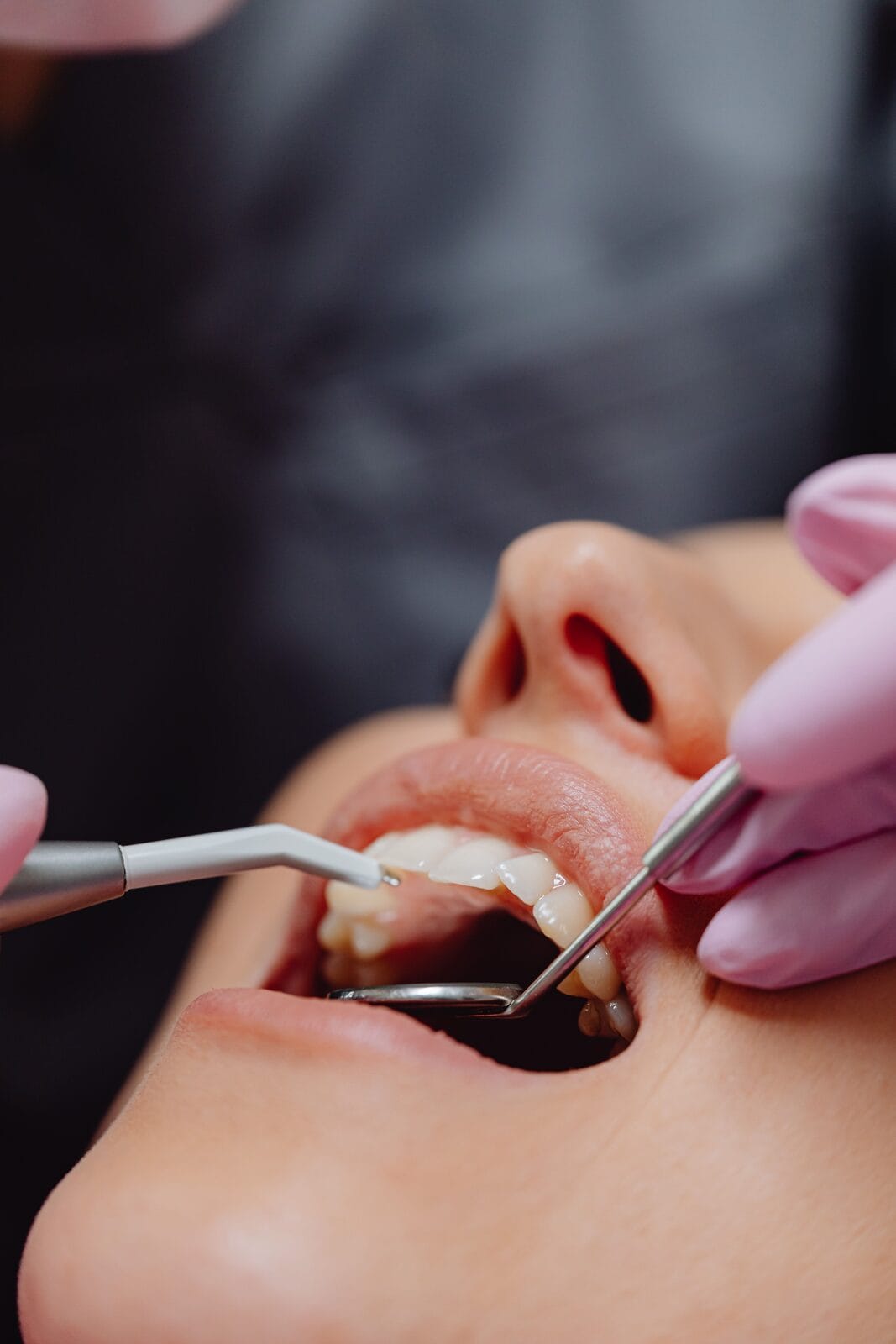 Examen clinique dentaire dans le cadre d'une démarche diagnostique en odontologie conservatrice