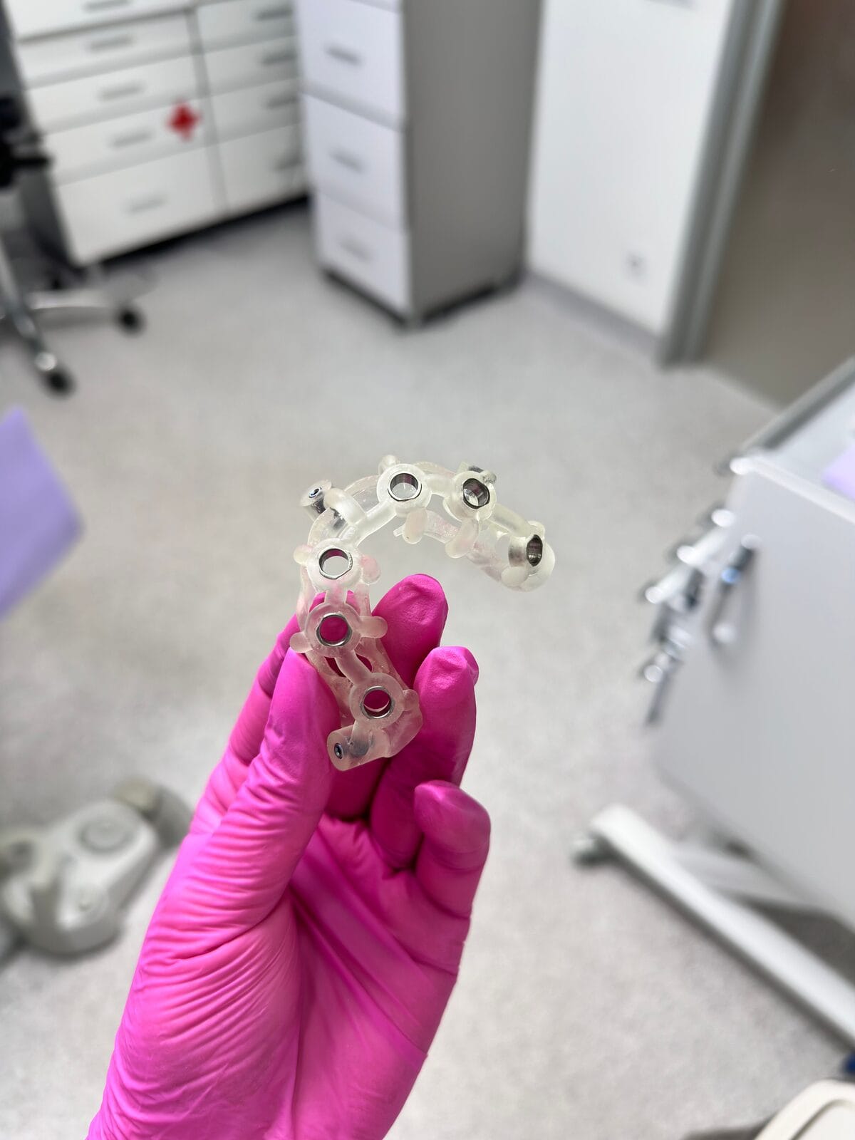 Guide chirurgical dentaire imprimé en 3D tenu en main gantée, utilisé pour la chirurgie implantaire guidée