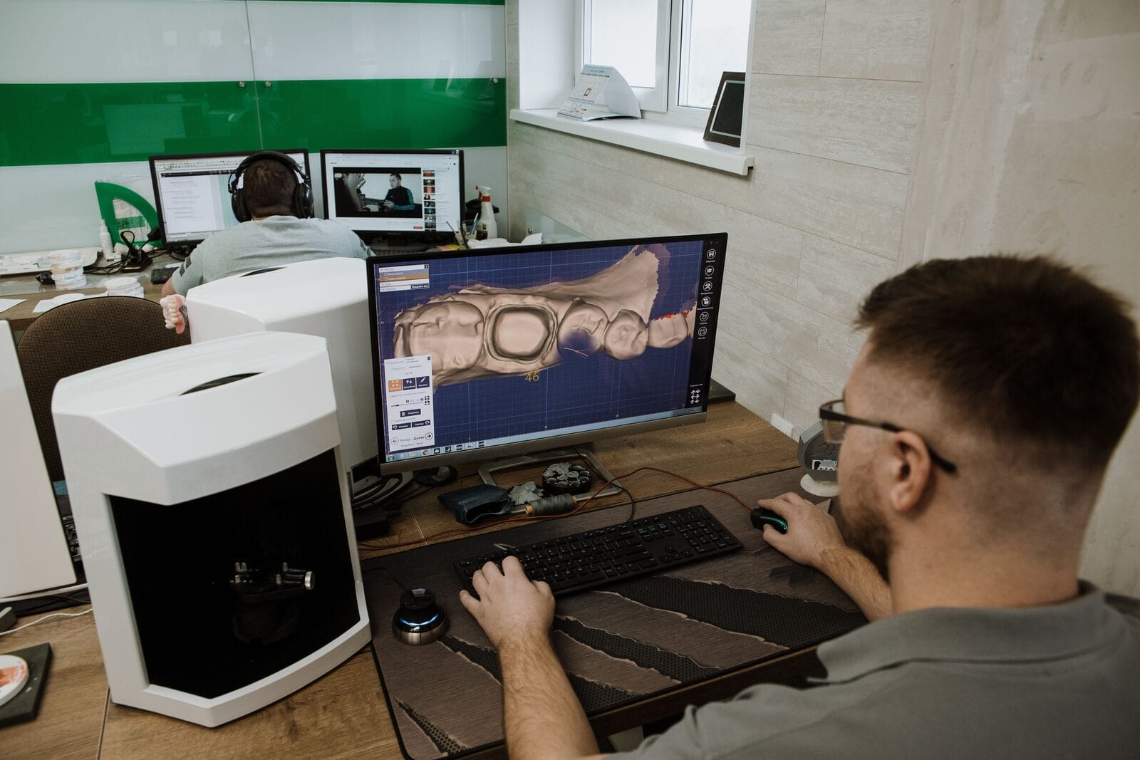 Logiciel de planification implantaire 3D : superposition CBCT et scan intra-oral pour positionnement virtuel des implants