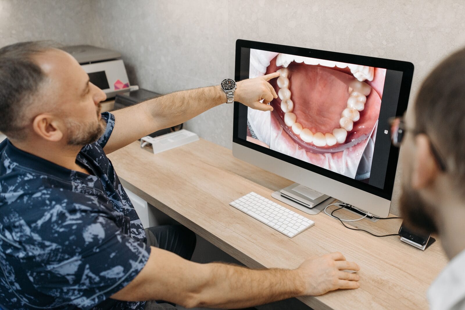 Workflow numérique implantaire intégré : scanner intra-oral, planification 3D et fabrication de guide chirurgical